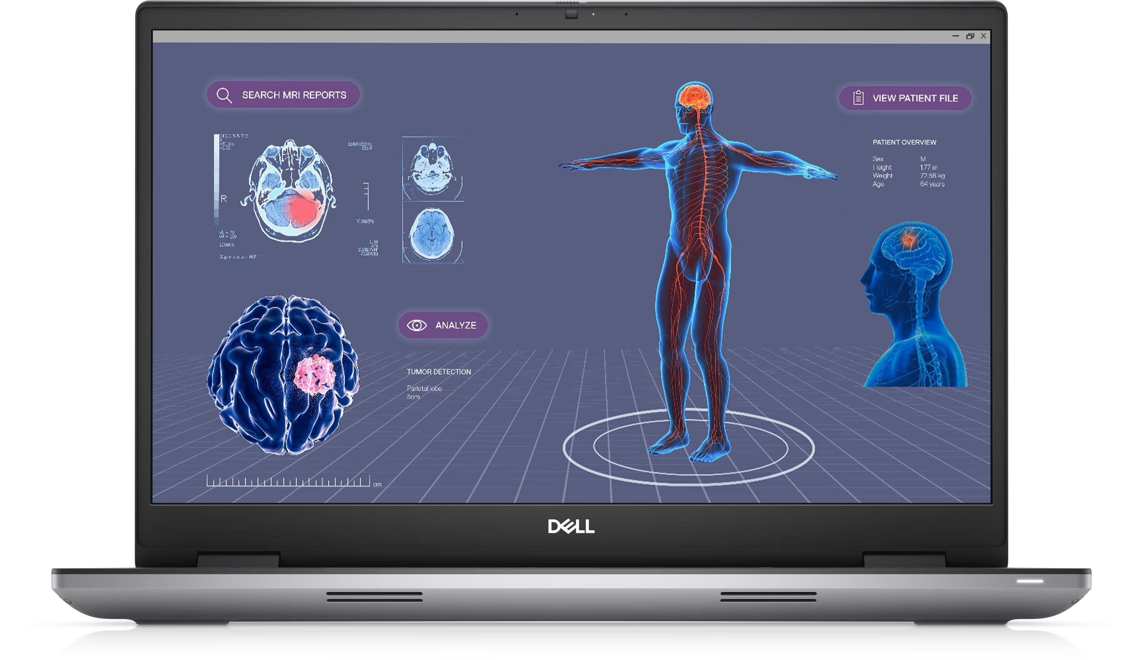 DELL Precision7780 【13950HX, RTX5000Ada】 Dell Precision 7780 Intel® Core™ i9-13950HX vPro® 64GB 1TB SSD 17